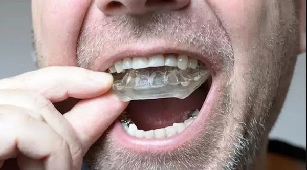 Không sử cho người bị viêm hoặc rối loạn khớp thái dương hàm Không sử cho người bị viêm hoặc rối loạn khớp thái dương hàm