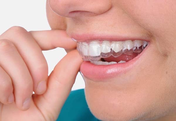 Để đảm bảo hiệu quả của máng, bạn cần tuân thủ nguyên tắc sử dụng Để đảm bảo hiệu quả của máng, bạn cần tuân thủ nguyên tắc sử dụng