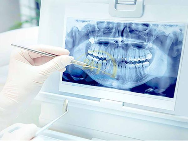 Từ hình ảnh nha khoa giúp bác sĩ chẩn đoán bệnh lý Từ hình ảnh nha khoa giúp bác sĩ chẩn đoán bệnh lý