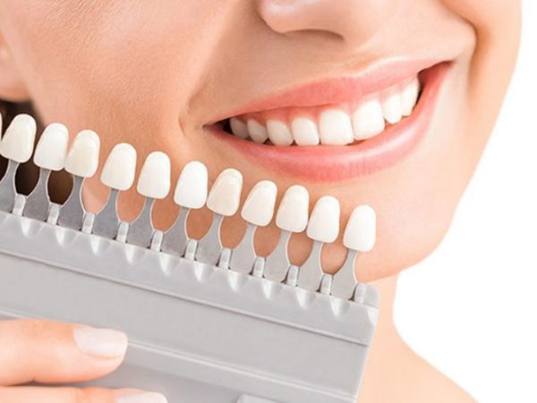 Cần cẩn thận khi sử dụng thuốc tẩy trắng răng đúng cách Cần cẩn thận khi sử dụng thuốc tẩy trắng răng đúng cách