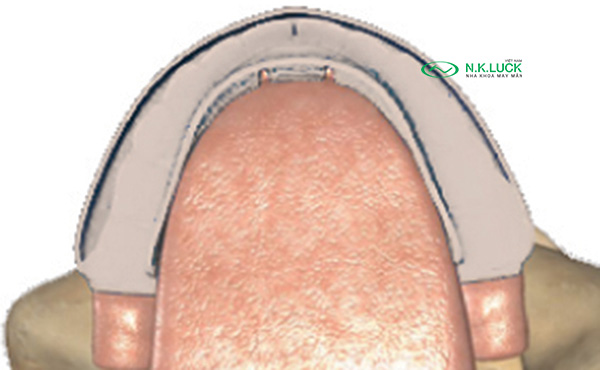 bước 3