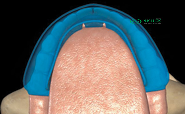 bước 3