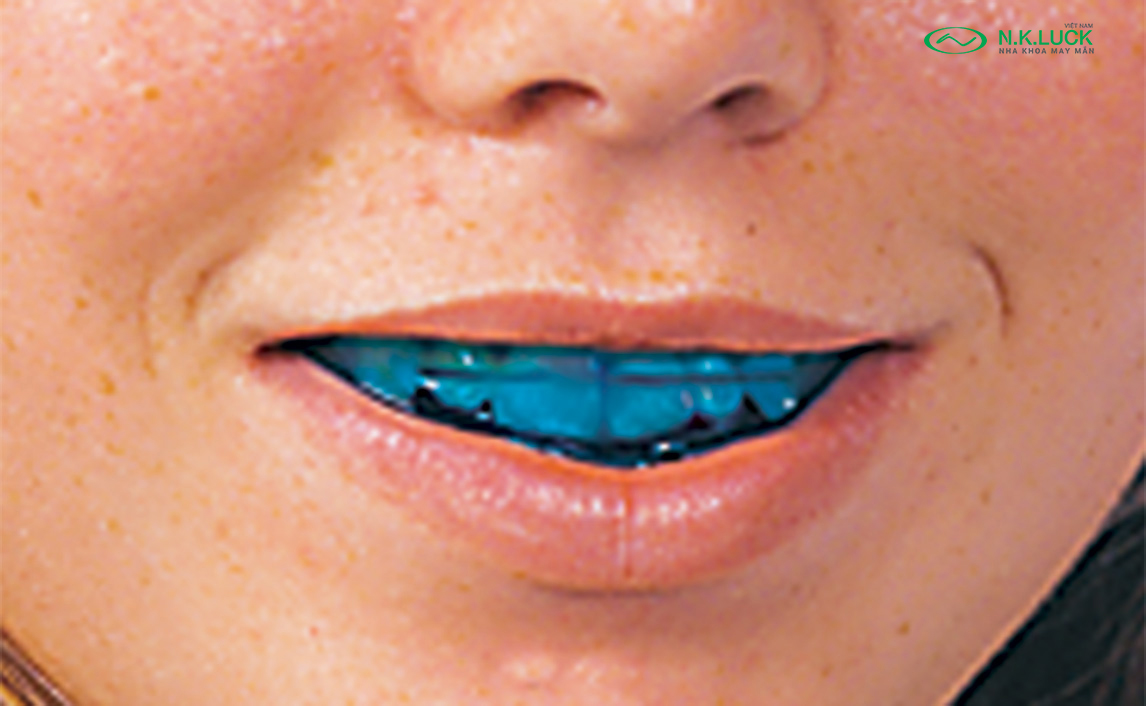 bước 4