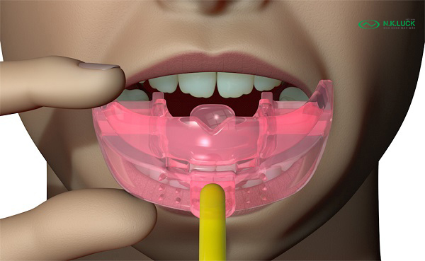 bước 2