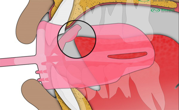 bước 3