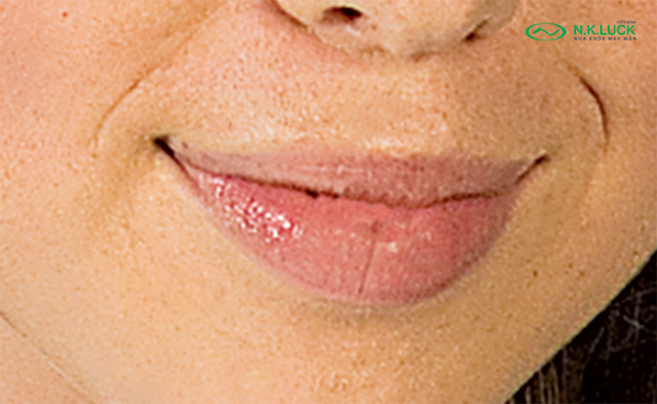 bước 5