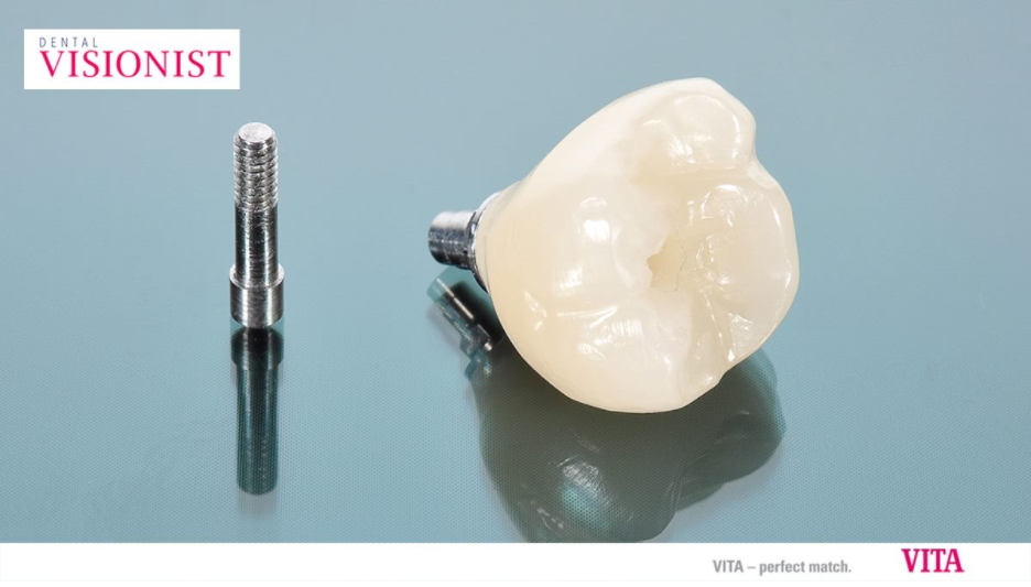 Phục hình răng sứ VITA