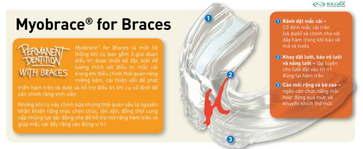 myobrace for brace