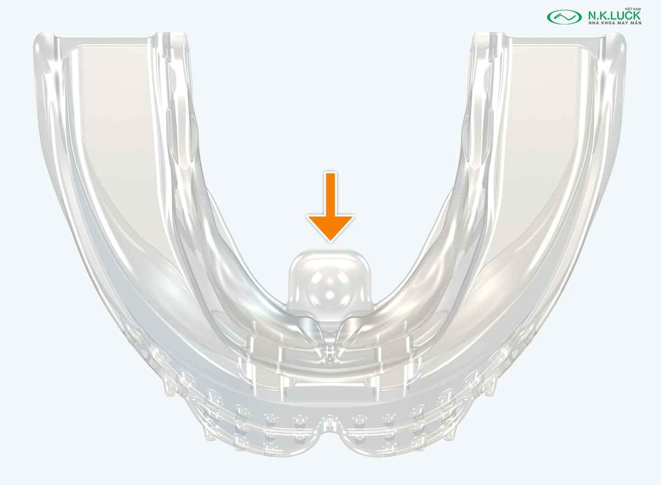 myobrace for brace B1 Ling sau