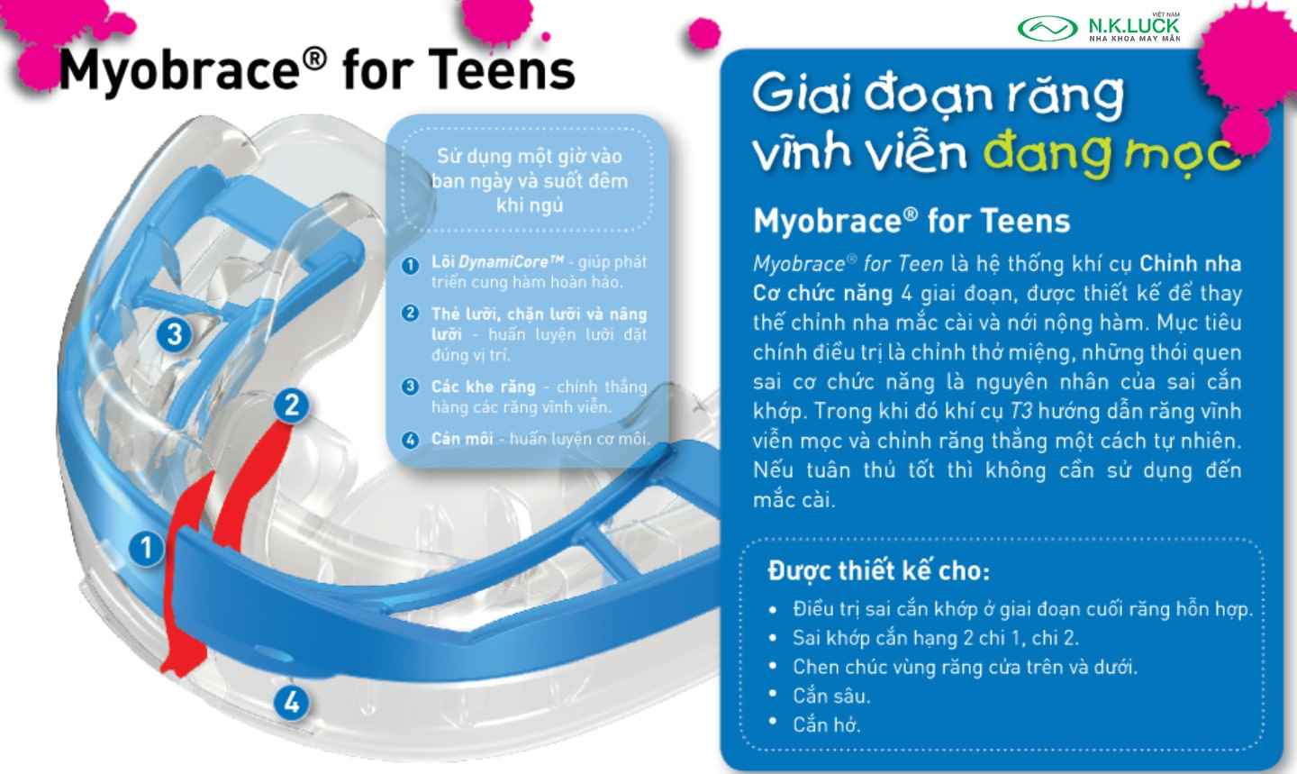 myobrace for teen