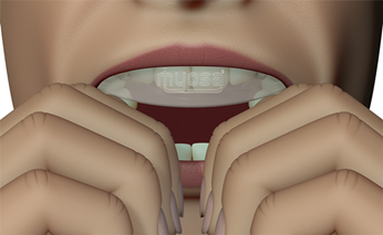 bước 3