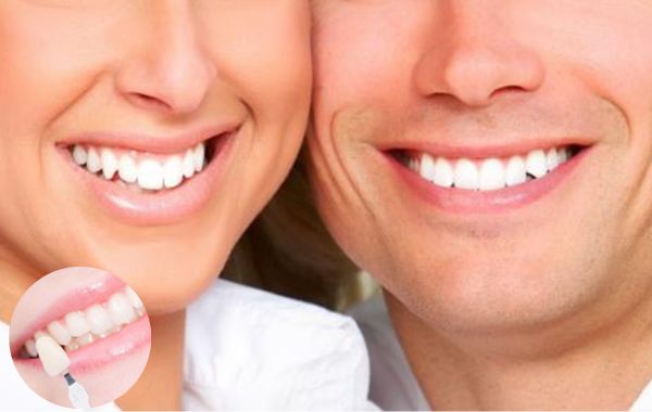 Chọn màu răng sứ theo giới tính là cách chọn màu răng sứ thẩm mỹ hiệu quả Chọn màu răng sứ theo giới tính là cách chọn màu răng sứ thẩm mỹ hiệu quả