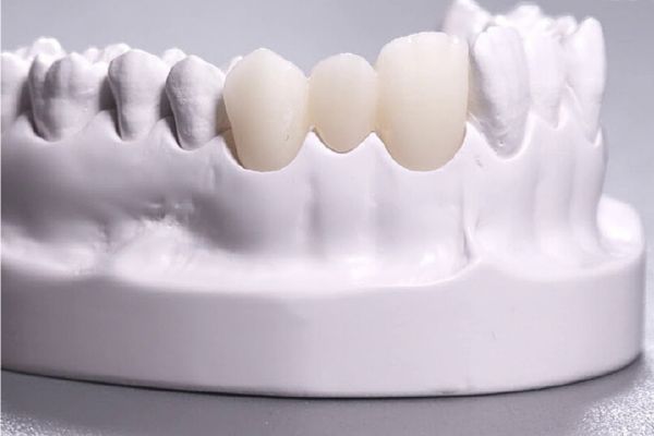 Răng sứ Zirconia là gì? Răng sứ Zirconia là gì?