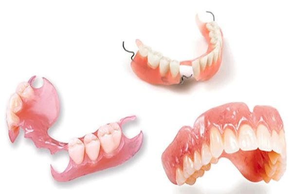 Ưu nhược điểm của răng tháo lắp cao cấp Ưu nhược điểm của răng tháo lắp cao cấp