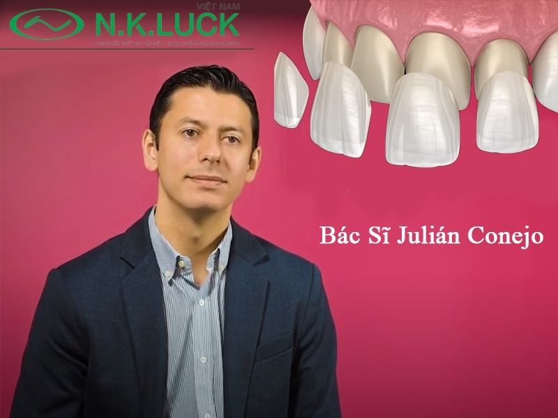 Lắng nghe chuyên gia chia sẻ về Veneer