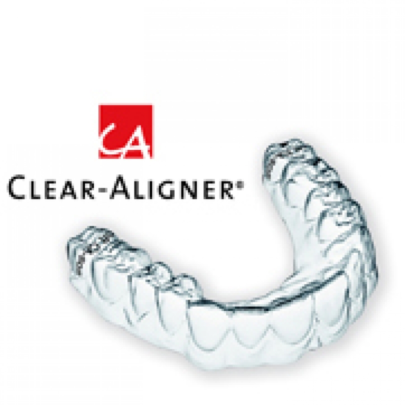 CLEAR-ALIGNER®