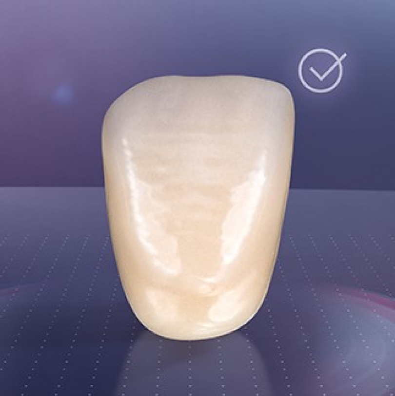 VITA MFT® Anterior - Răng cửa
